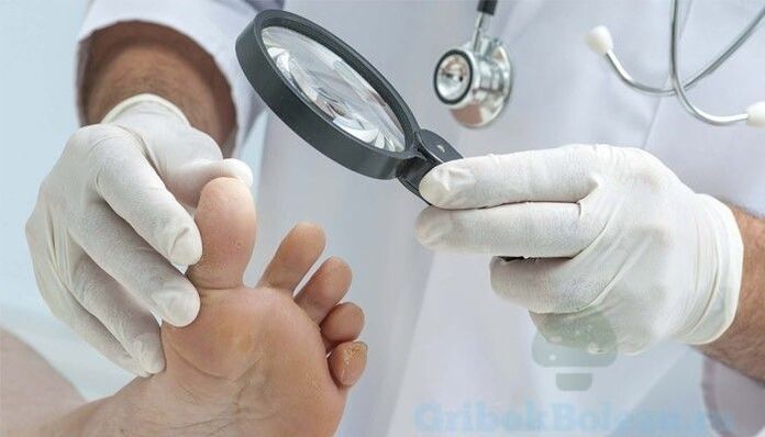 mediku batek oinaren onddoaren diagnostikoa