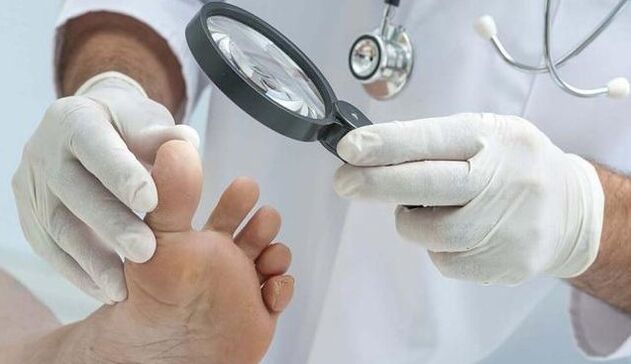 Onddoen diagnostikoa